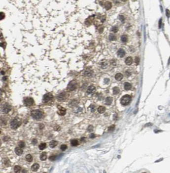 SPANXA1 Rabbit Polyclonal Antibody