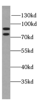 SPART Antibody
