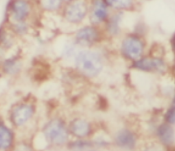 SPRR2D Antibody