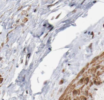 SS18L2 Antibody