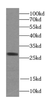 STARD3NL Antibody