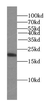 STMN3 Mouse Monoclonal Antibody