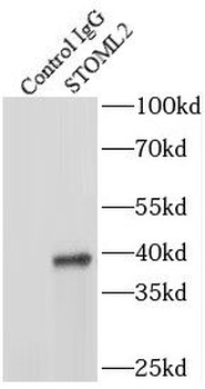 STOML2 Antibody