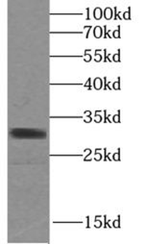 SULT1A4 Rabbit Polyclonal Antibody
