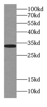 SULT4A1 Antibody