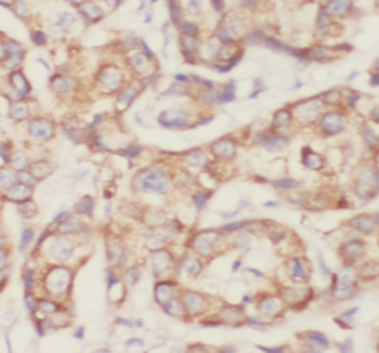 SUMF2 Antibody