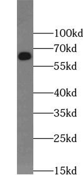 SHOC2 Rabbit Polyclonal Antibody