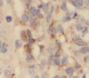 SYT4 Rabbit Polyclonal Antibody