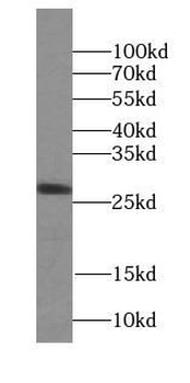 STX10 Antibody