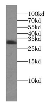 STX3 Rabbit Polyclonal Antibody