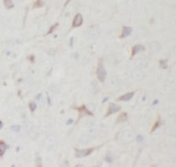 STX6 Antibody