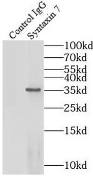 STX7 Antibody