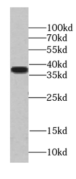 TADA1 Antibody