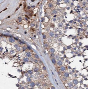 TADA1 Antibody