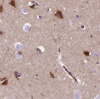 Talpid3 Rabbit Polyclonal Antibody