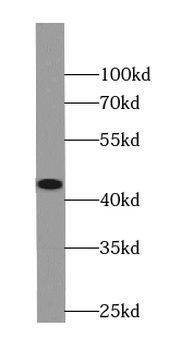 TARDBP Rabbit Polyclonal Antibody