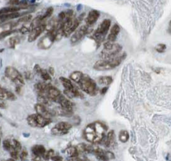 TARDBP Rabbit Polyclonal Antibody