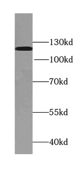 TDRD5 Rabbit Polyclonal Antibody