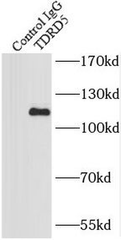 TDRD5 Rabbit Polyclonal Antibody