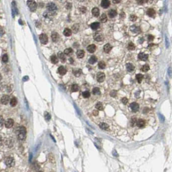TDRD5 Rabbit Polyclonal Antibody