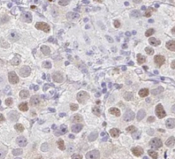 TDRKH Antibody