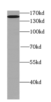 TEX15 Rabbit Polyclonal Antibody