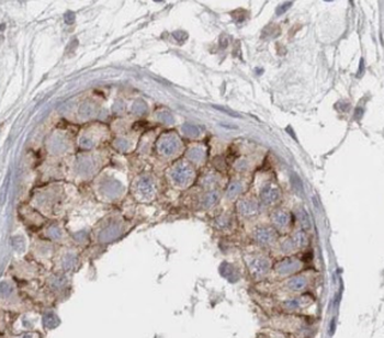 TEX15 Rabbit Polyclonal Antibody