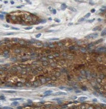 TFIP11 Antibody