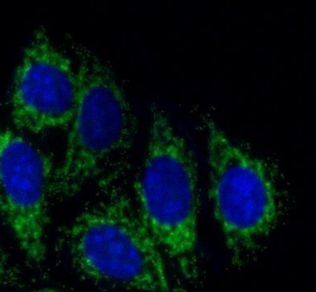 TGFB2 Antibody