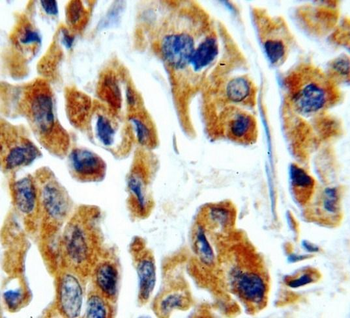 TGFB2 Antibody