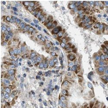 TG Rabbit Polyclonal Antibody
