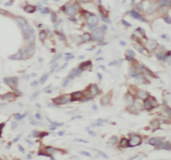 TLE3 Antibody