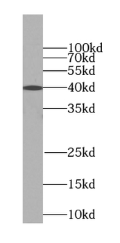TMEM106B Antibody