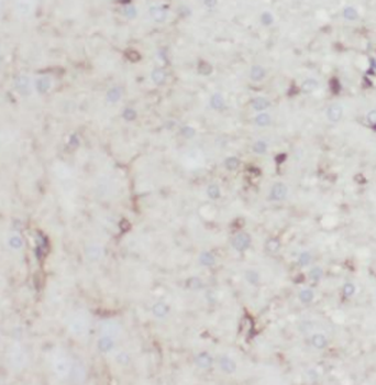 TMEM106B Antibody