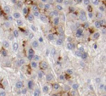 TMEM181 Rabbit Polyclonal Antibody