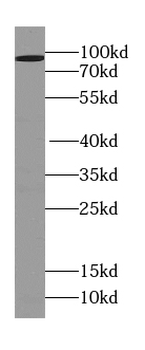 C2CD2L Rabbit Polyclonal Antibody