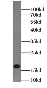 TMEM70 Mouse Monoclonal Antibody