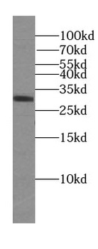 DRAM2 Antibody