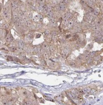 TMF1 Antibody