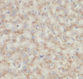 TOMM40 Antibody