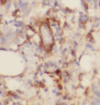 TOMM6 Antibody