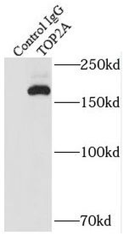 TOP2A Antibody