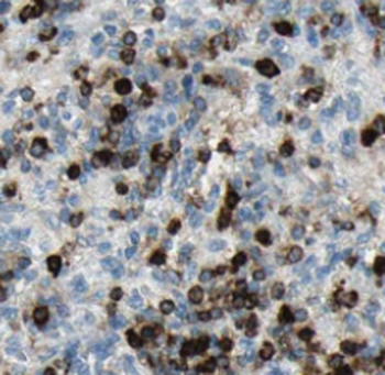 TOP2A Antibody