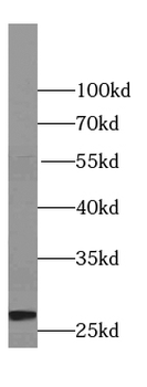 TPI1 Mouse Monoclonal Antibody