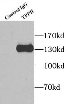 TPP2 Antibody