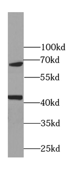 TTF1 Specific Mouse Monoclonal Antibody