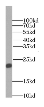 TAGLN2 Antibody
