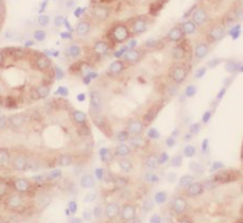 TAGLN2 Antibody