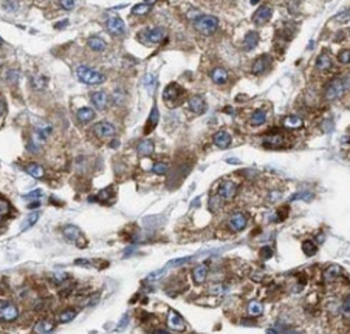 TKT Antibody