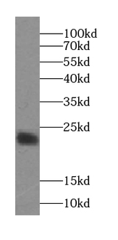 SSR2 Antibody